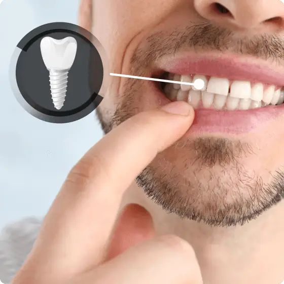 Implant Dentar Timișoara- Dental Concept by Dr. Mihali