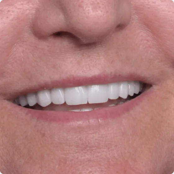 Protetică dentară Dental Concept by Dr. Mihali